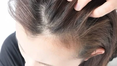 تفسير حلم تساقط الشعر بغزارة: فقدان أم فرج قريب؟