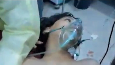 "انقطع النفس" كلمات طفل يمني وهو يلفظ أنفاسه الأخيرة بعد إصابته بصاروخ حوثي (فيديو)