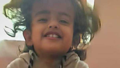 صورة الطفلة اليمنية "ليان" المتـفحمة تشعل مواقع التواصل الاجتماعي (فيديو)