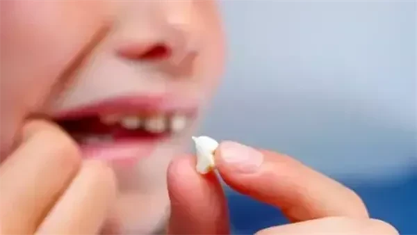 تفسير حلم سقوط الناب العلوي: دلالات الخير والتحذير